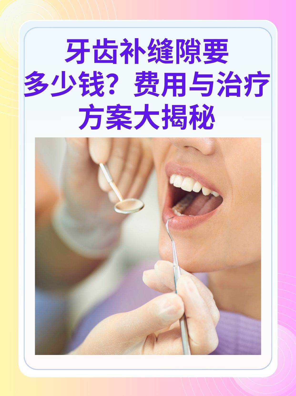 南阳补牙医保可以报销吗(补牙医保可以报销吗 哪些可以报销呢)